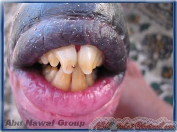 Fish With Human Teeth